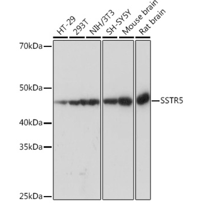 SSTR5 Rabbit Monoclonal Antibody