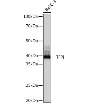 TFPI Rabbit Monoclonal Antibody