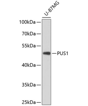 PUS1 Rabbit Polyclonal Antibody