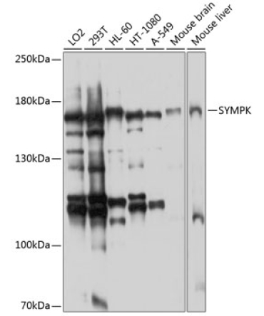 SYMPK Rabbit Polyclonal Antibody