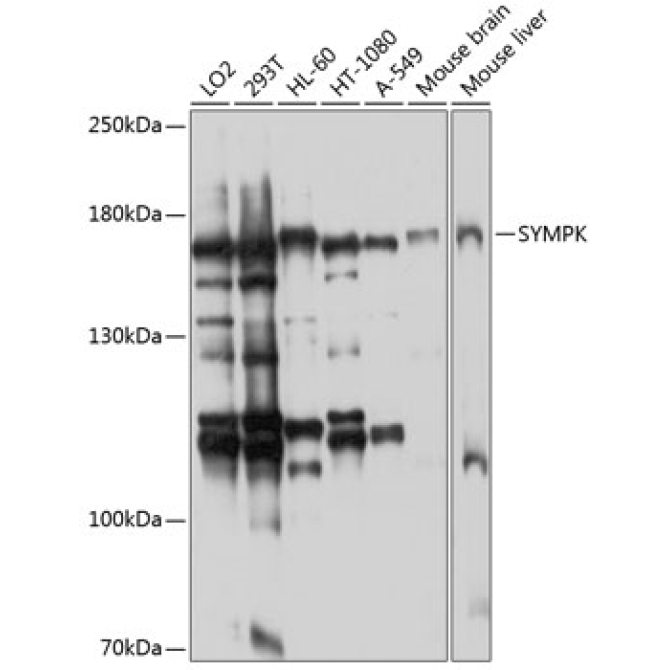 SYMPK Rabbit Polyclonal Antibody