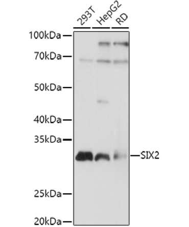 SIX2 Rabbit Polyclonal Antibody
