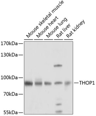 THOP1 Rabbit Polyclonal Antibody