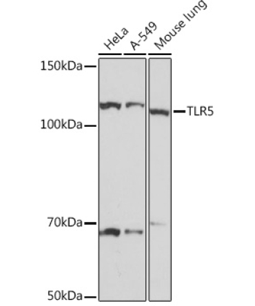 TLR5 Rabbit Monoclonal Antibody