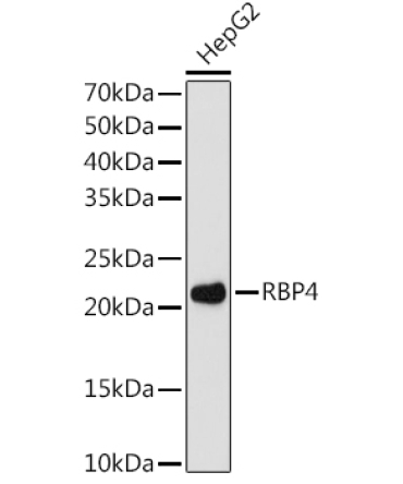 RBP4 Rabbit Monoclonal Antibody