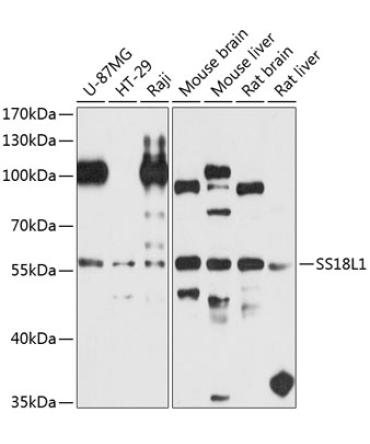 SS18L1 Rabbit Polyclonal Antibody