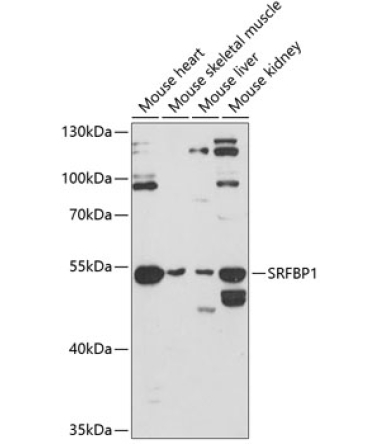 SRFBP1 Rabbit Polyclonal Antibody