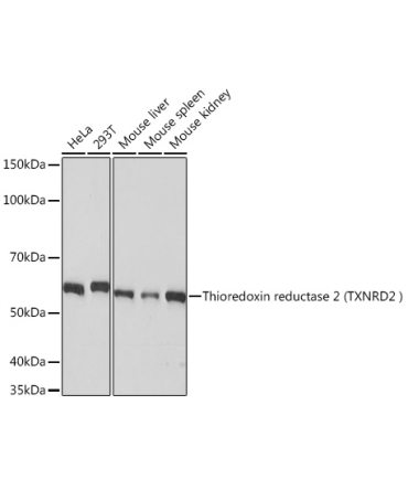 Thioredoxin reductase 2 (TXNRD2 ) Rabbit Monoclonal Antibody