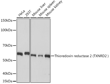 Thioredoxin reductase 2 (TXNRD2 ) Rabbit Monoclonal Antibody