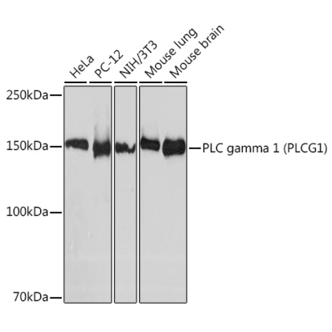 PLC gamma 1 (PLCG1) Rabbit Monoclonal Antibody