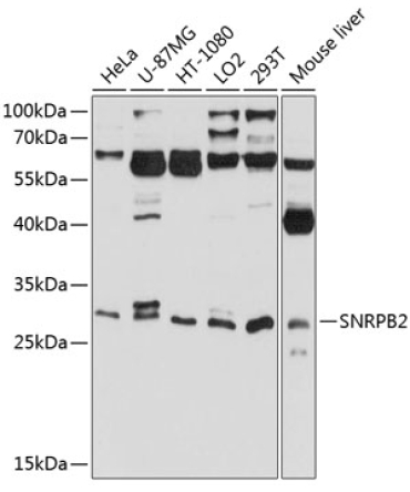SNRPB2 Rabbit Polyclonal Antibody