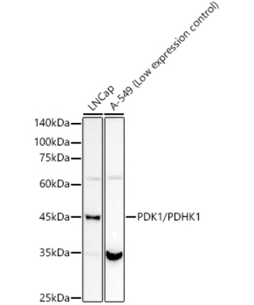 PDK1/PDHK1 Rabbit Monoclonal Antibody