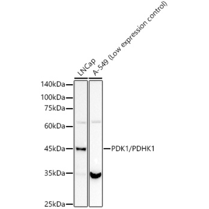 PDK1/PDHK1 Rabbit Monoclonal Antibody