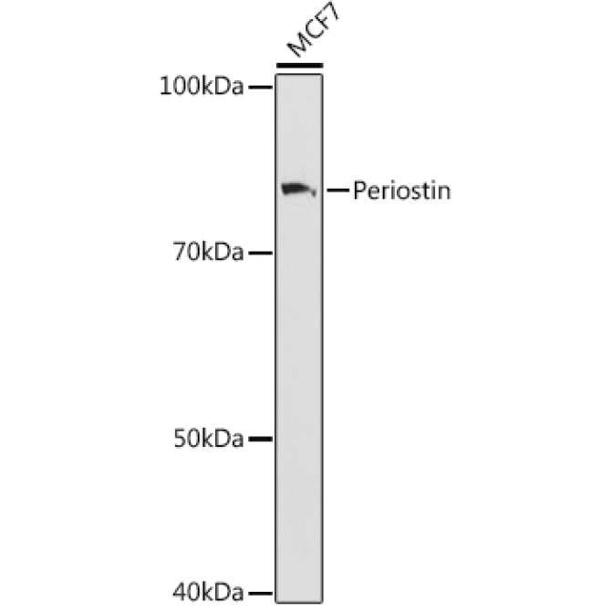 Periostin Rabbit Monoclonal Antibody