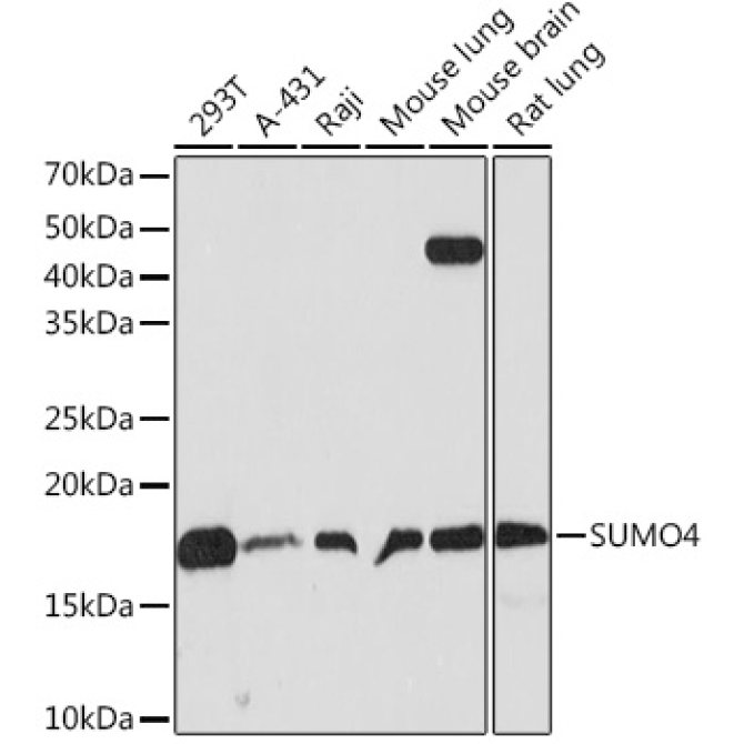 SUMO4 Rabbit Monoclonal Antibody