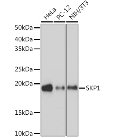 SKP1 Rabbit Monoclonal Antibody