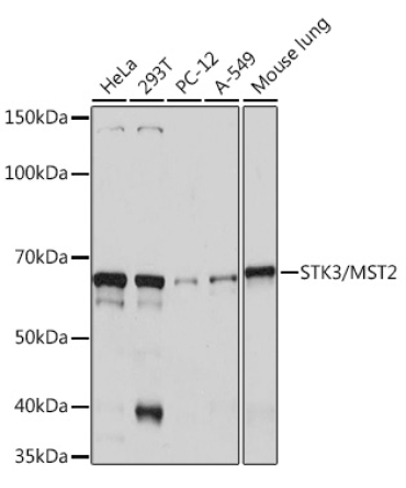 STK3/MST2 Rabbit Monoclonal Antibody
