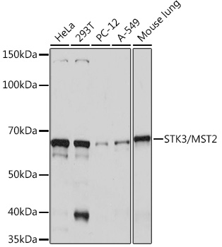 STK3/MST2 Rabbit Monoclonal Antibody