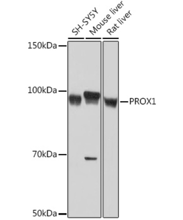 PROX1 Rabbit Monoclonal Antibody