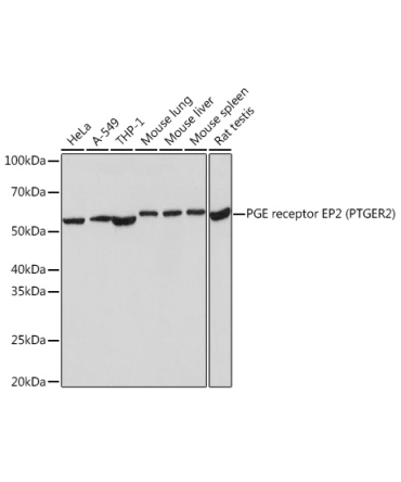 PGE receptor EP2 (PTGER2) Rabbit Monoclonal Antibody