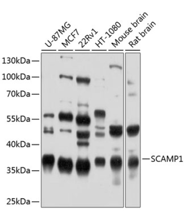 SCAMP1 Rabbit Polyclonal Antibody