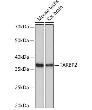 TARBP2 Rabbit Monoclonal Antibody
