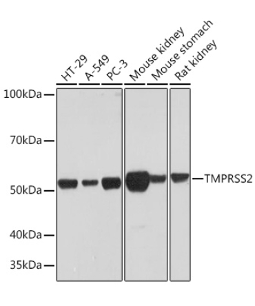 TMPRSS2 Rabbit Monoclonal Antibody