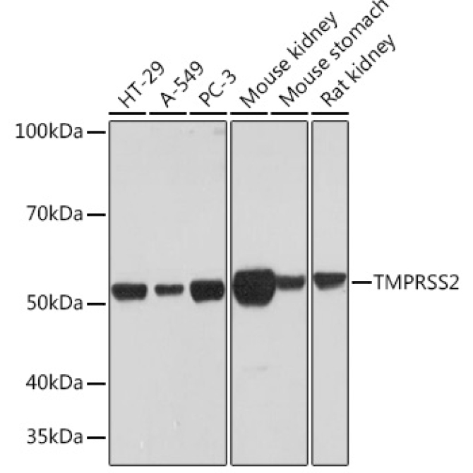 TMPRSS2 Rabbit Monoclonal Antibody