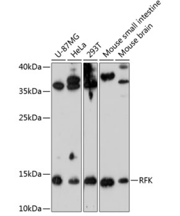 RFK Rabbit Polyclonal Antibody