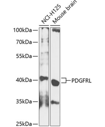 PDGFRL Rabbit Polyclonal Antibody