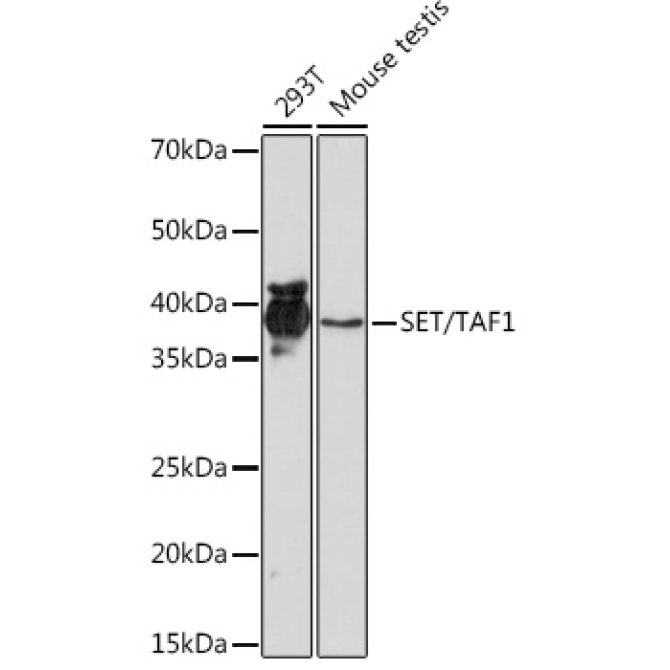 SET/TAF1 Rabbit Monoclonal Antibody