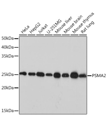 PSMA2 Rabbit Monoclonal Antibody