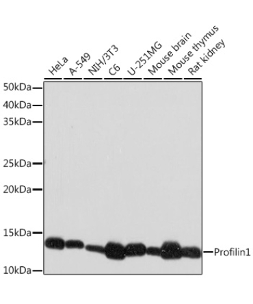 Profilin1 Rabbit Monoclonal Antibody