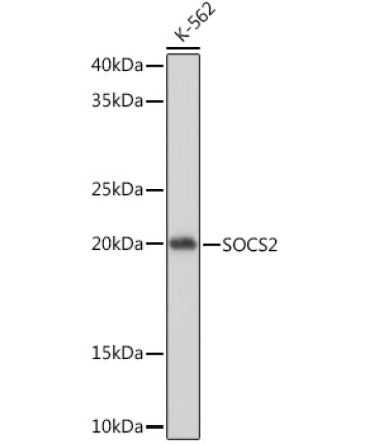SOCS2 Rabbit Monoclonal Antibody