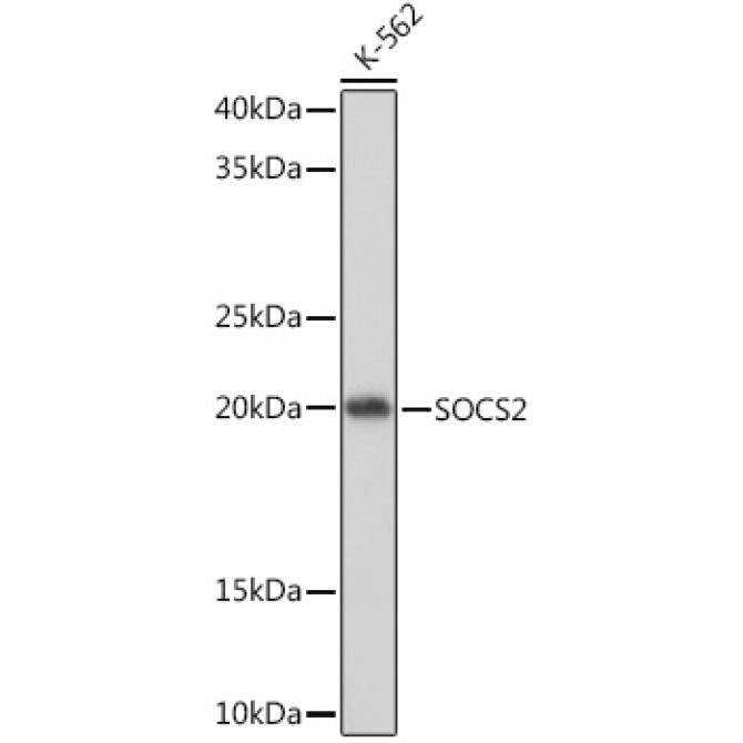 SOCS2 Rabbit Monoclonal Antibody