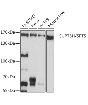SUPT5H/SPT5 Rabbit Polyclonal Antibody