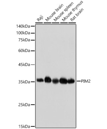 PIM2 Rabbit Monoclonal Antibody