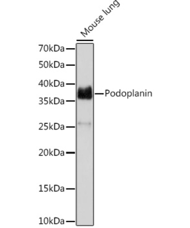 Podoplanin Rabbit Monoclonal Antibody
