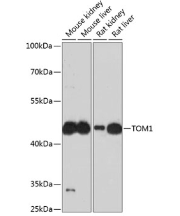 TOM1 Rabbit Polyclonal Antibody