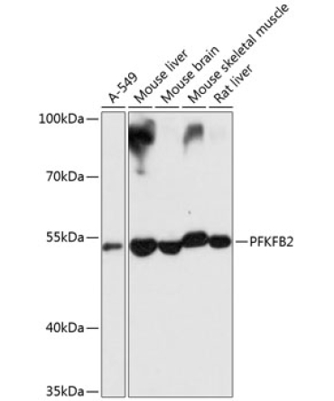 PFKFB2 Rabbit Polyclonal Antibody