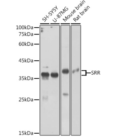 SRR Rabbit Polyclonal Antibody