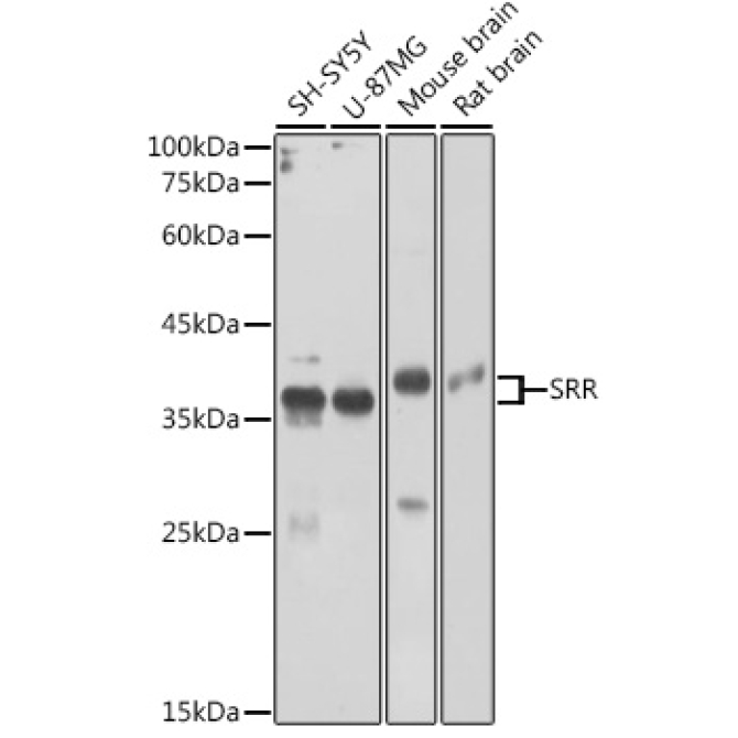 SRR Rabbit Polyclonal Antibody