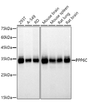 PPP6C Rabbit Monoclonal Antibody