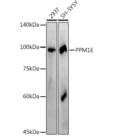 PPM1E Rabbit Monoclonal Antibody