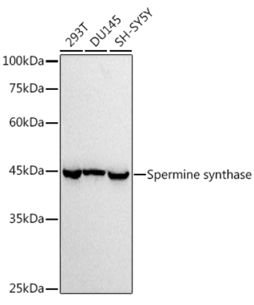Spermine synthase Rabbit Monoclonal Antibody