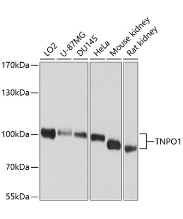 TNPO1 Rabbit Polyclonal Antibody