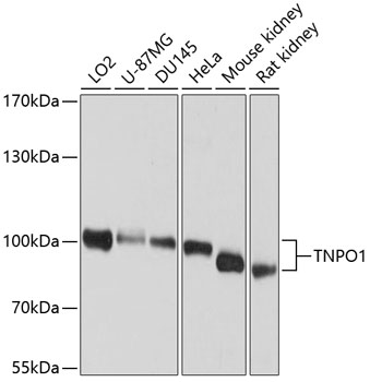 TNPO1 Rabbit Polyclonal Antibody