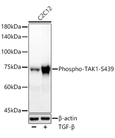 Phospho-TAK1-S439 Rabbit Monoclonal Antibody