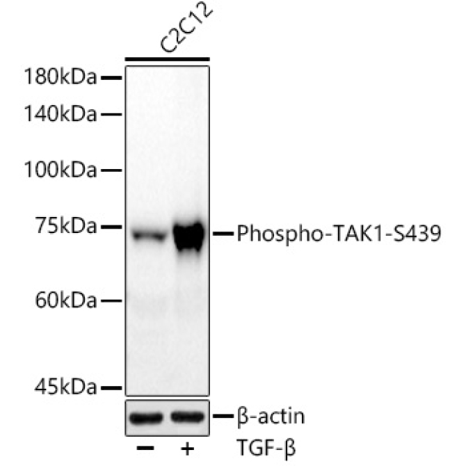Phospho-TAK1-S439 Rabbit Monoclonal Antibody