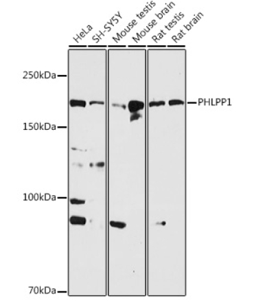 PHLPP1 Rabbit Polyclonal Antibody